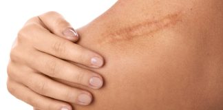 Cicatricile, semnele care ne leaga de trecut