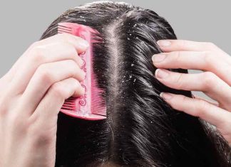 De ce apare matreata si cum o putem preveni?